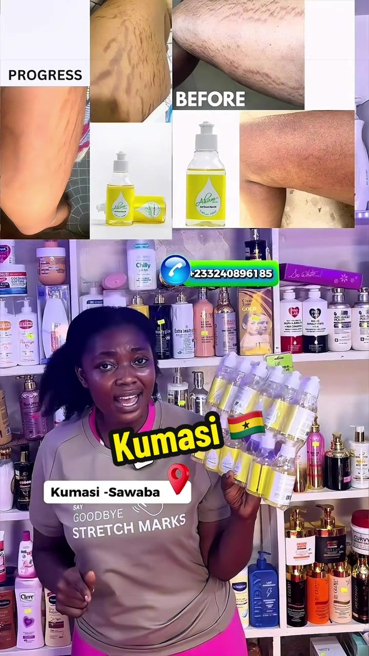@No1 STRETCH MARKS PRODUCT