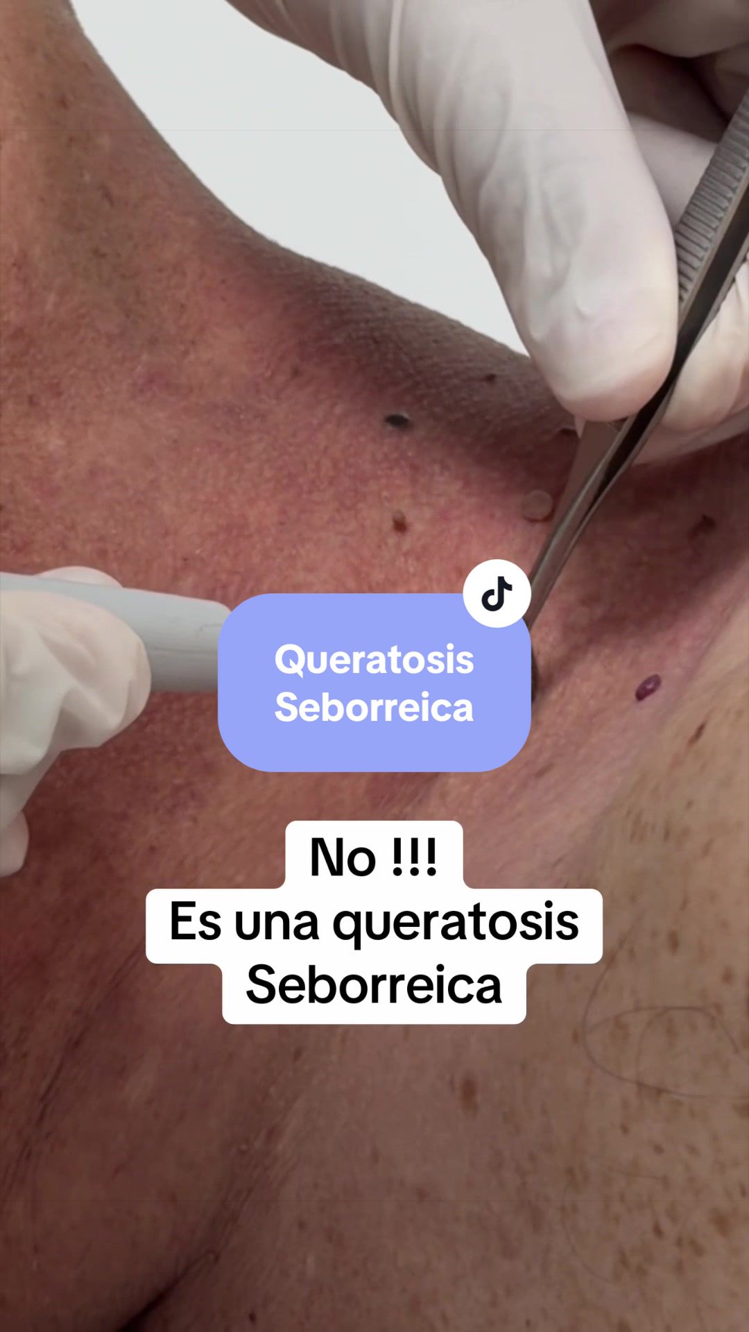 @Dr Christian Palacios derma