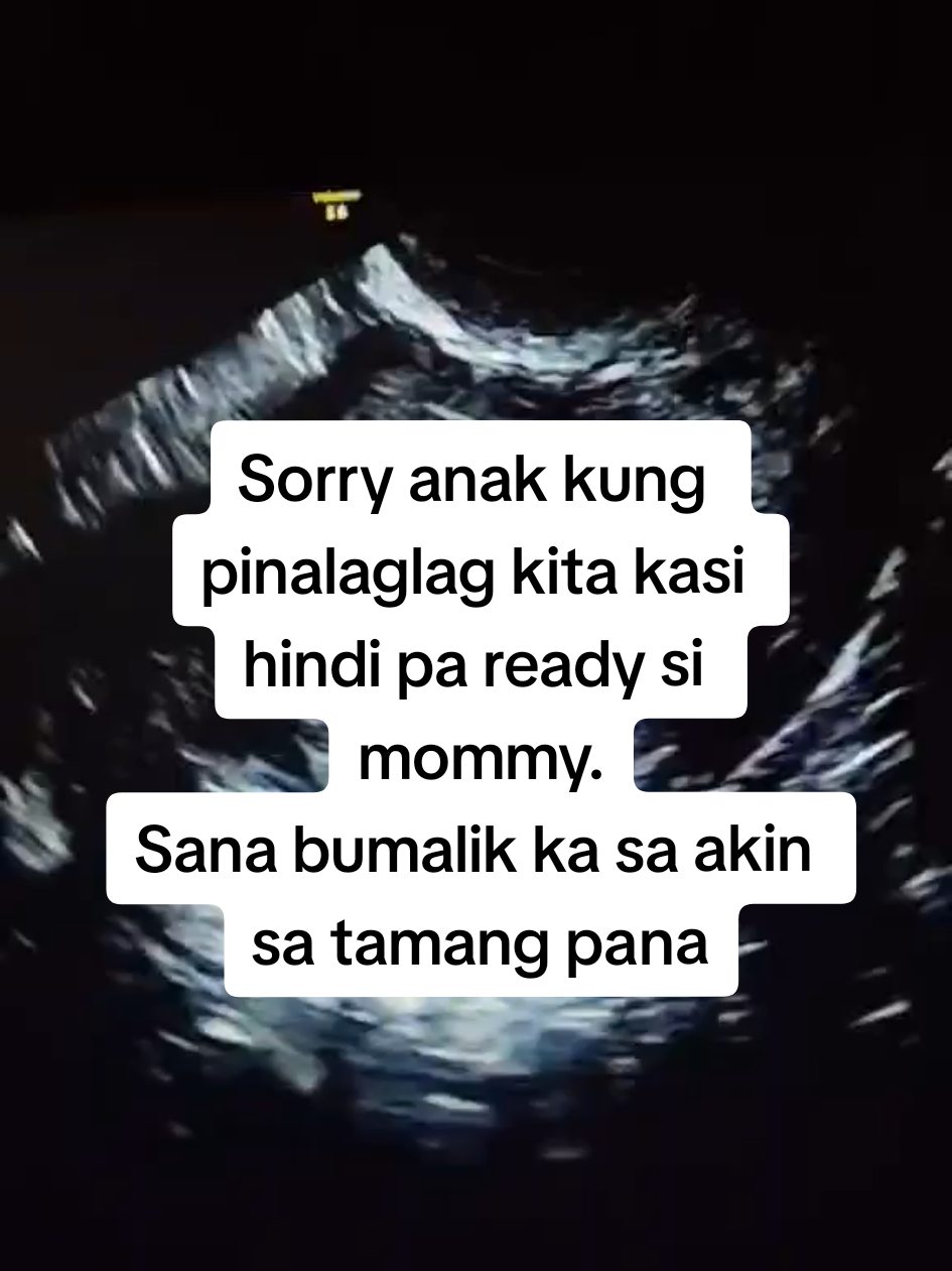 @Carmela Cojuanco