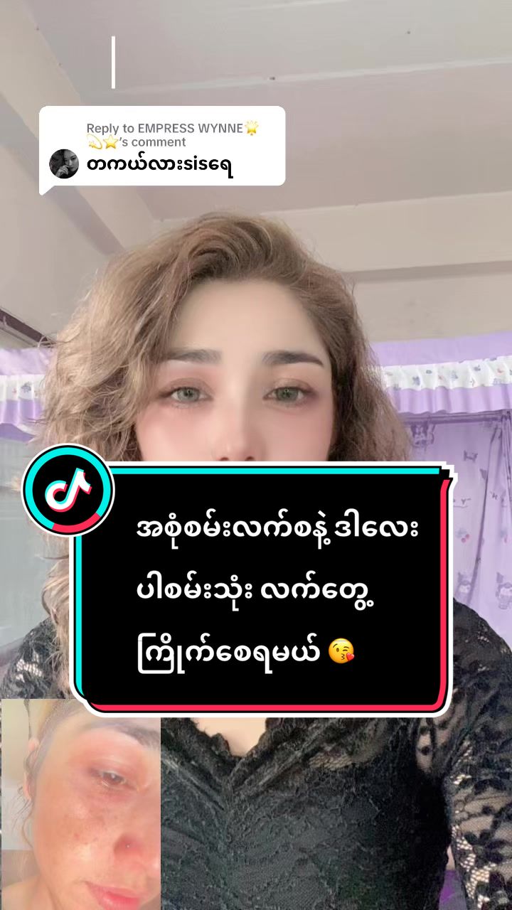 @BotayaHerb-Offical-တင်းတိပ်ဆေး