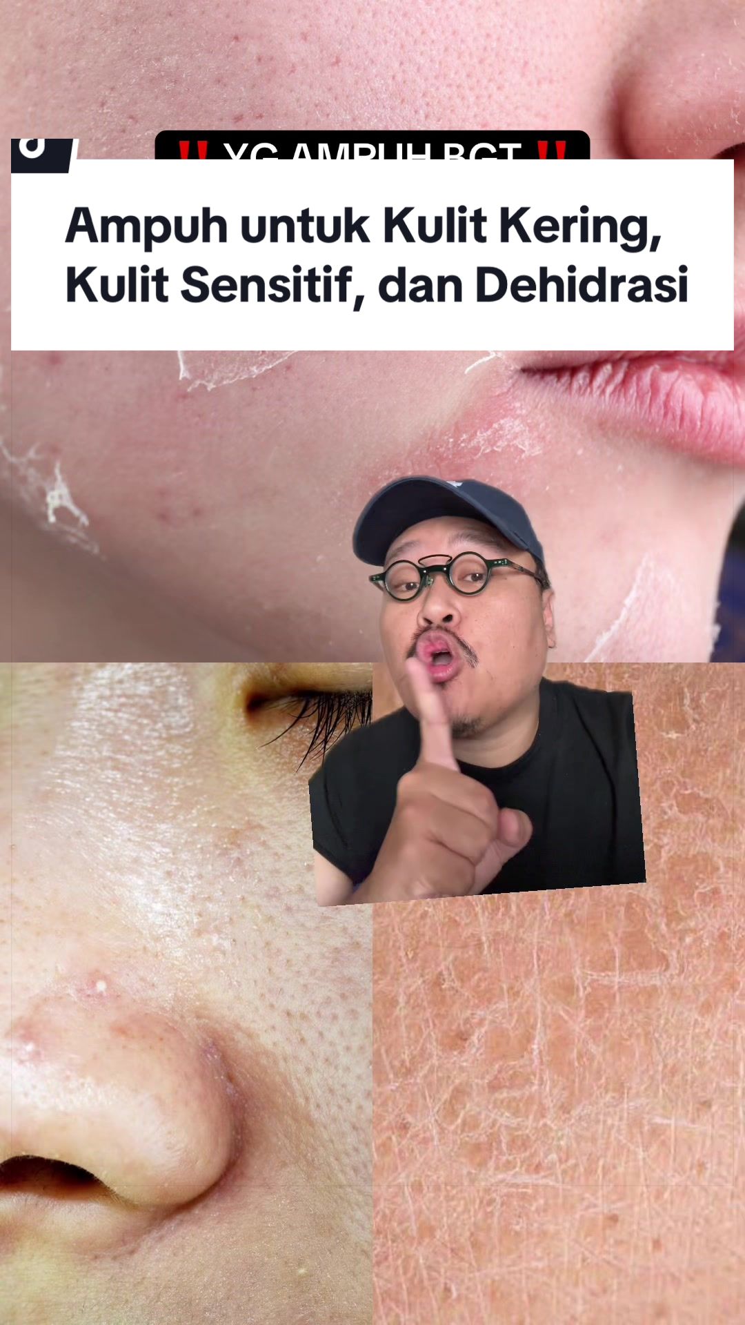 @Ali | @HungryForSkincare