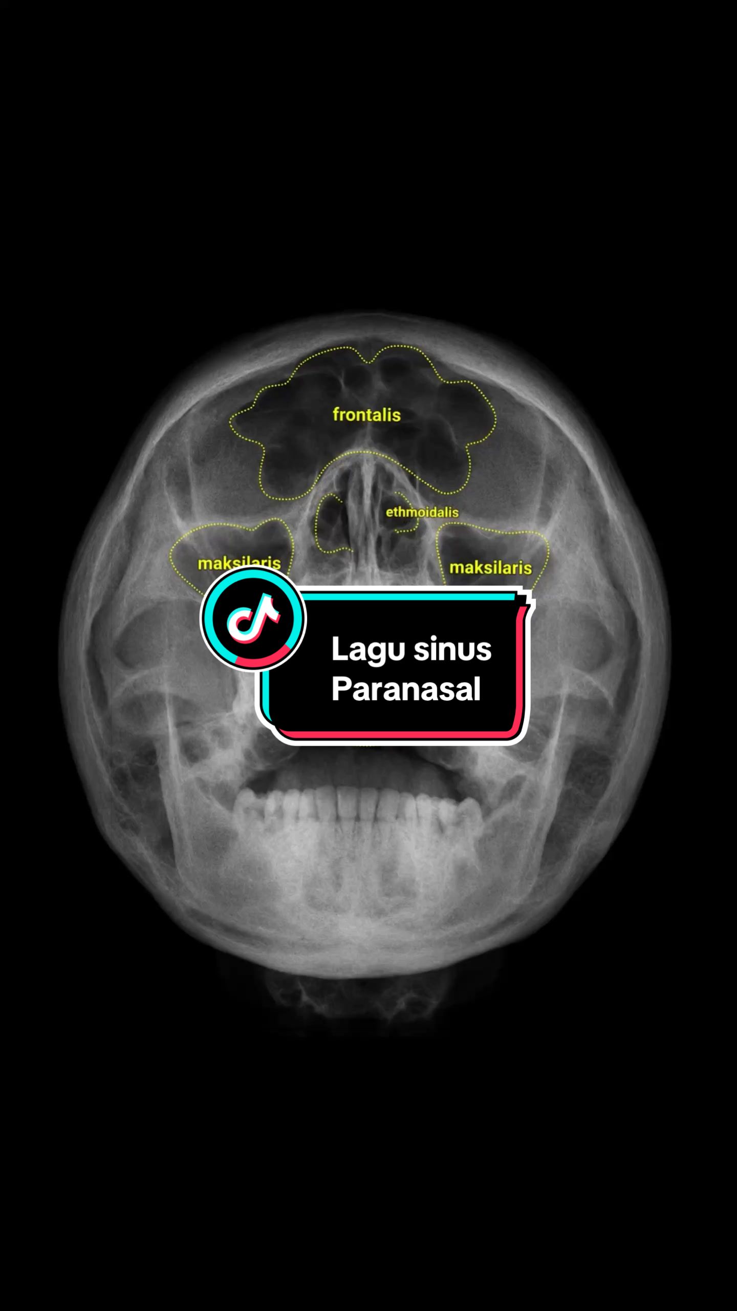 @Sobat Radiology