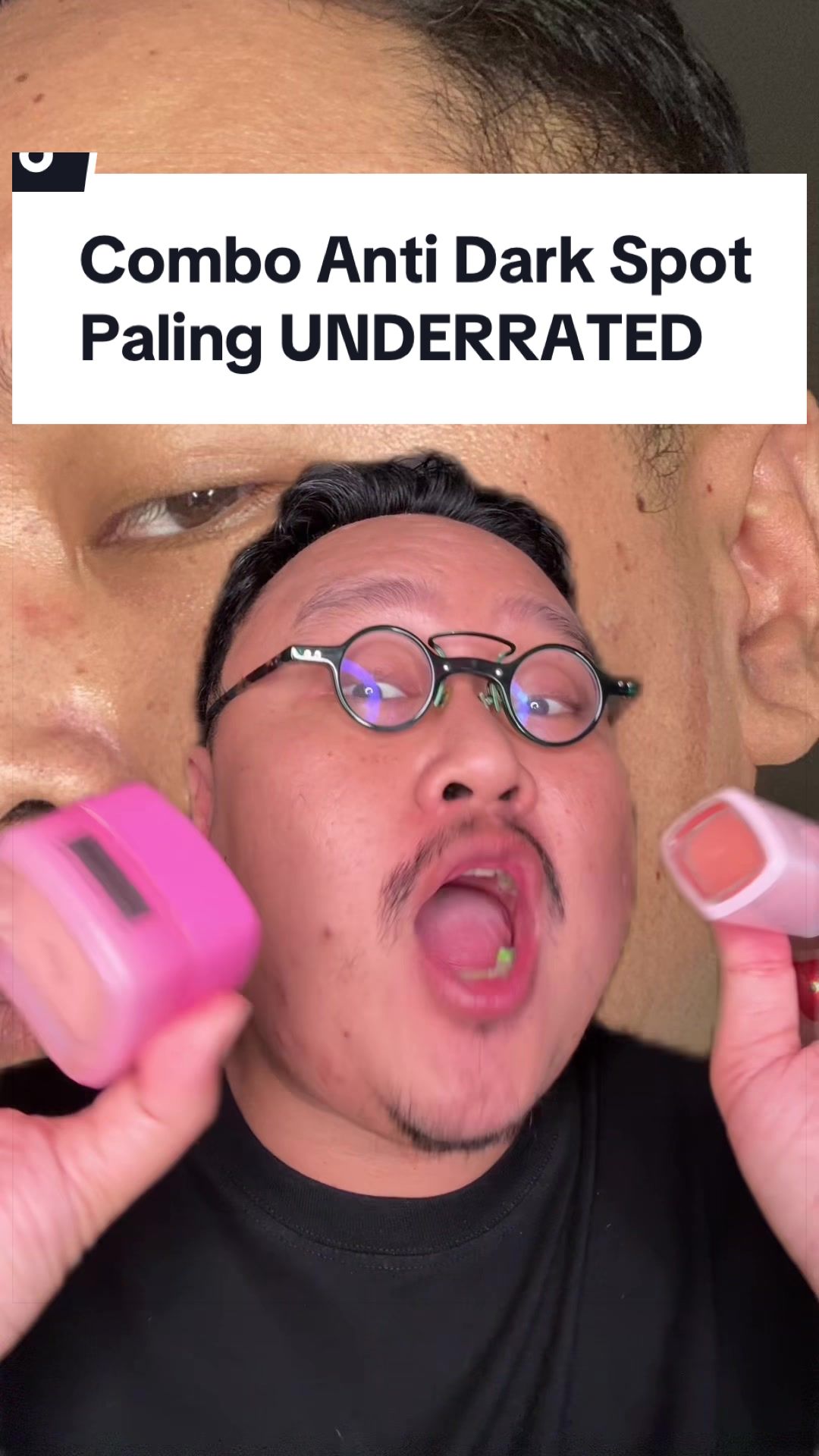 @Ali | @HungryForSkincare