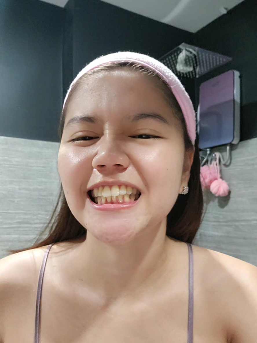 @Aly