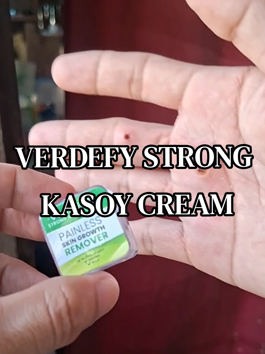 @𝚛𝚎𝚗𝚣𝚒𝚎𝚎