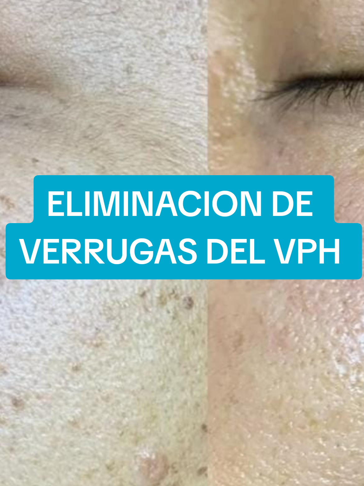 @VPH2025