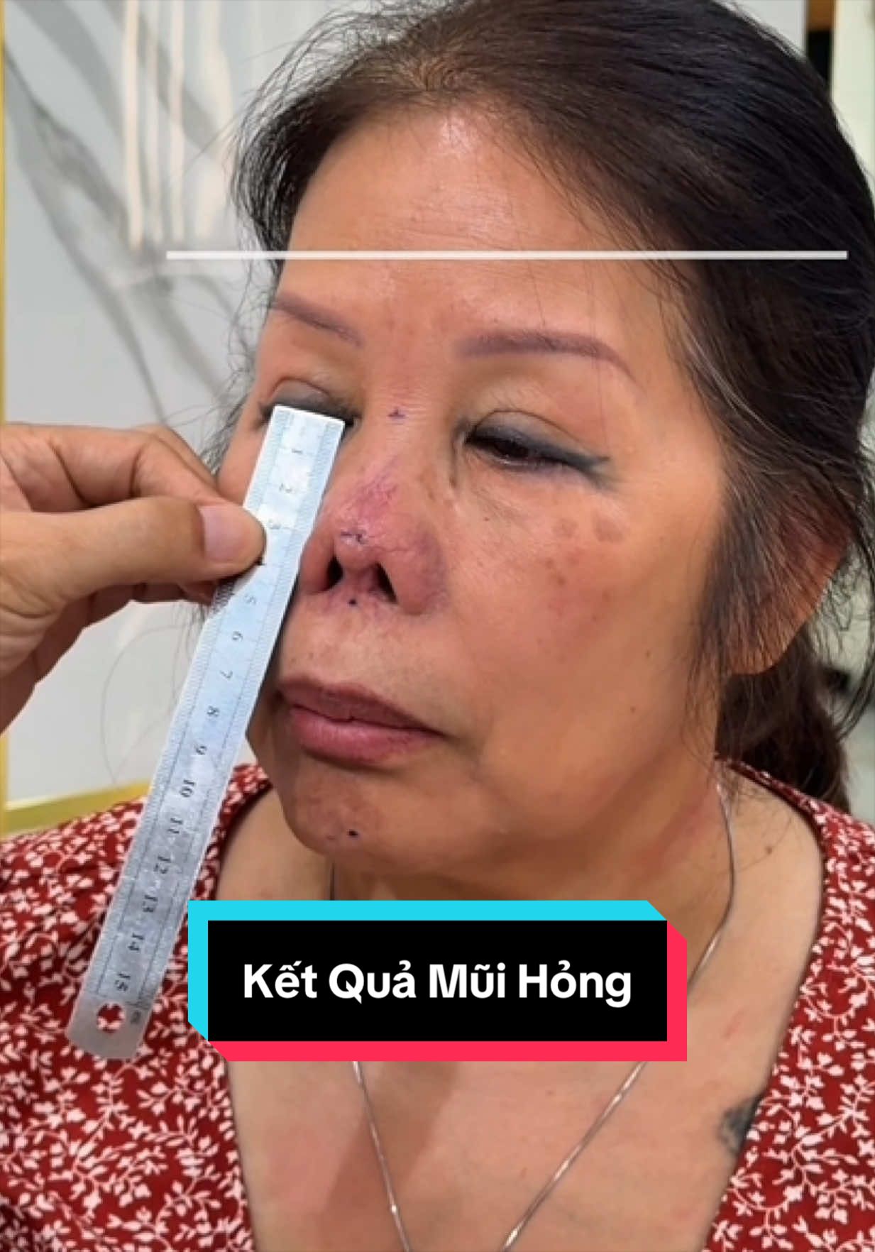 @Bs Nguyễn Tiến Huy