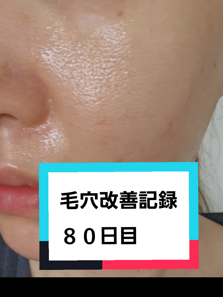 @リアル毛穴改善記録
