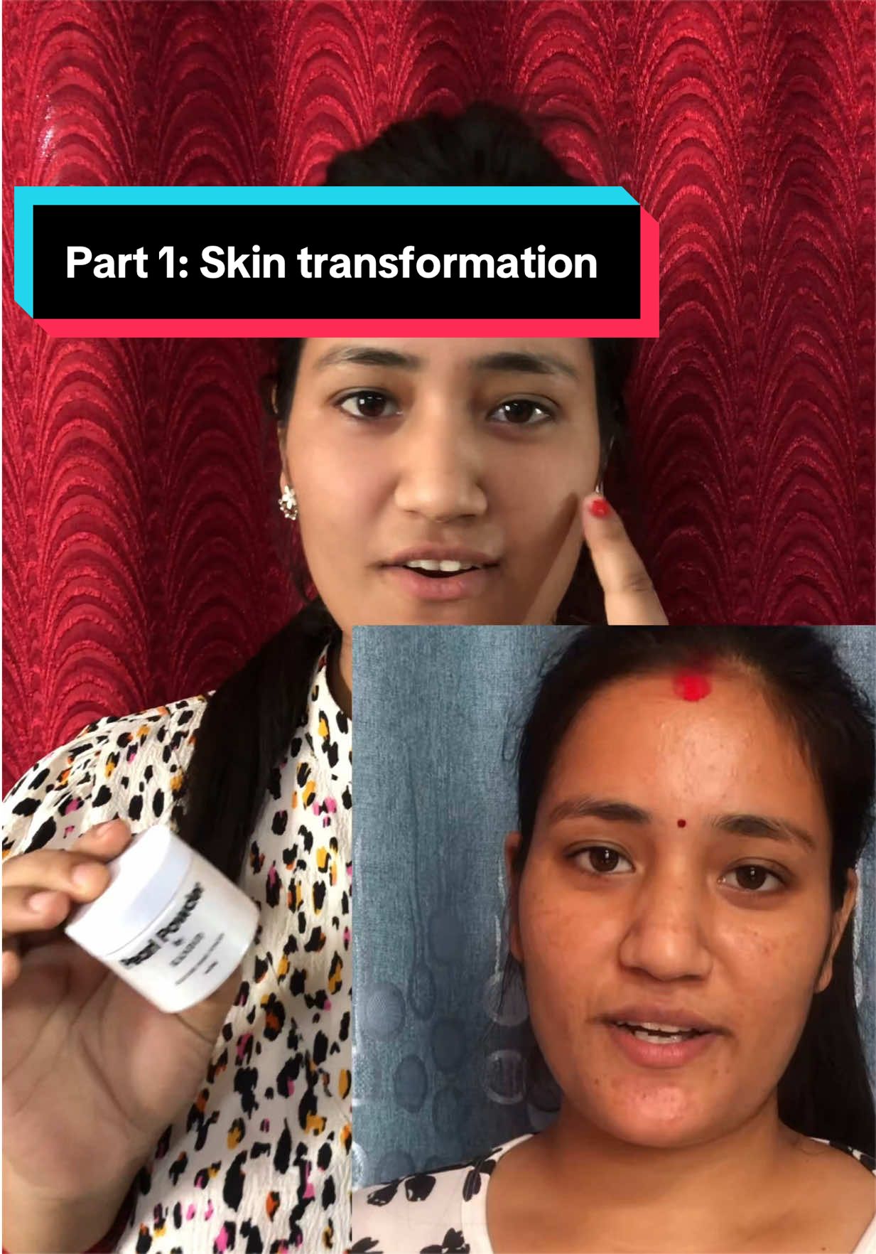 @Minimagic Skincare🇳🇵
