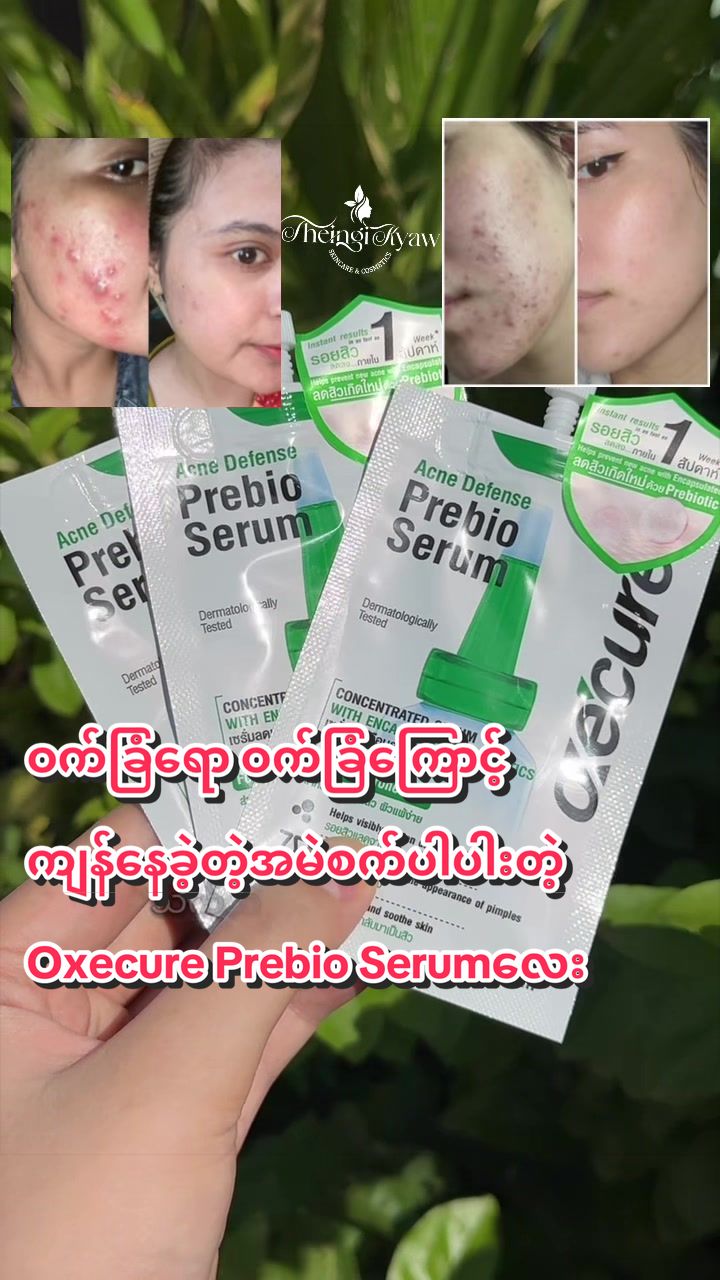 @FB: TheingiKyawSkincareShop