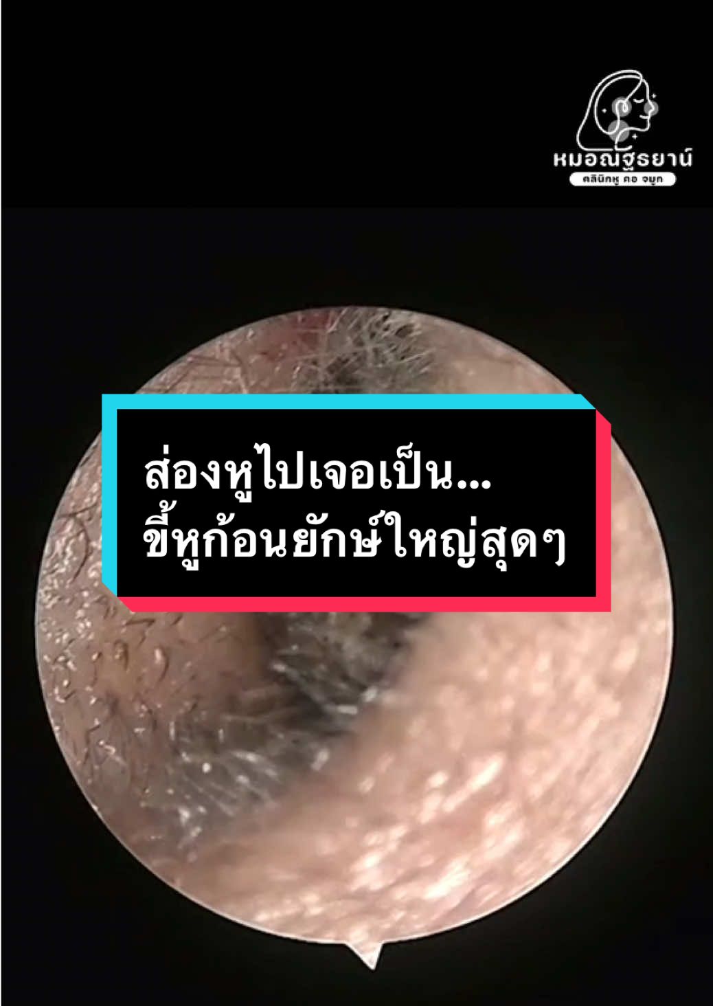 @คลินิกหมอณัฐธยาน์ หู คอ จมูก