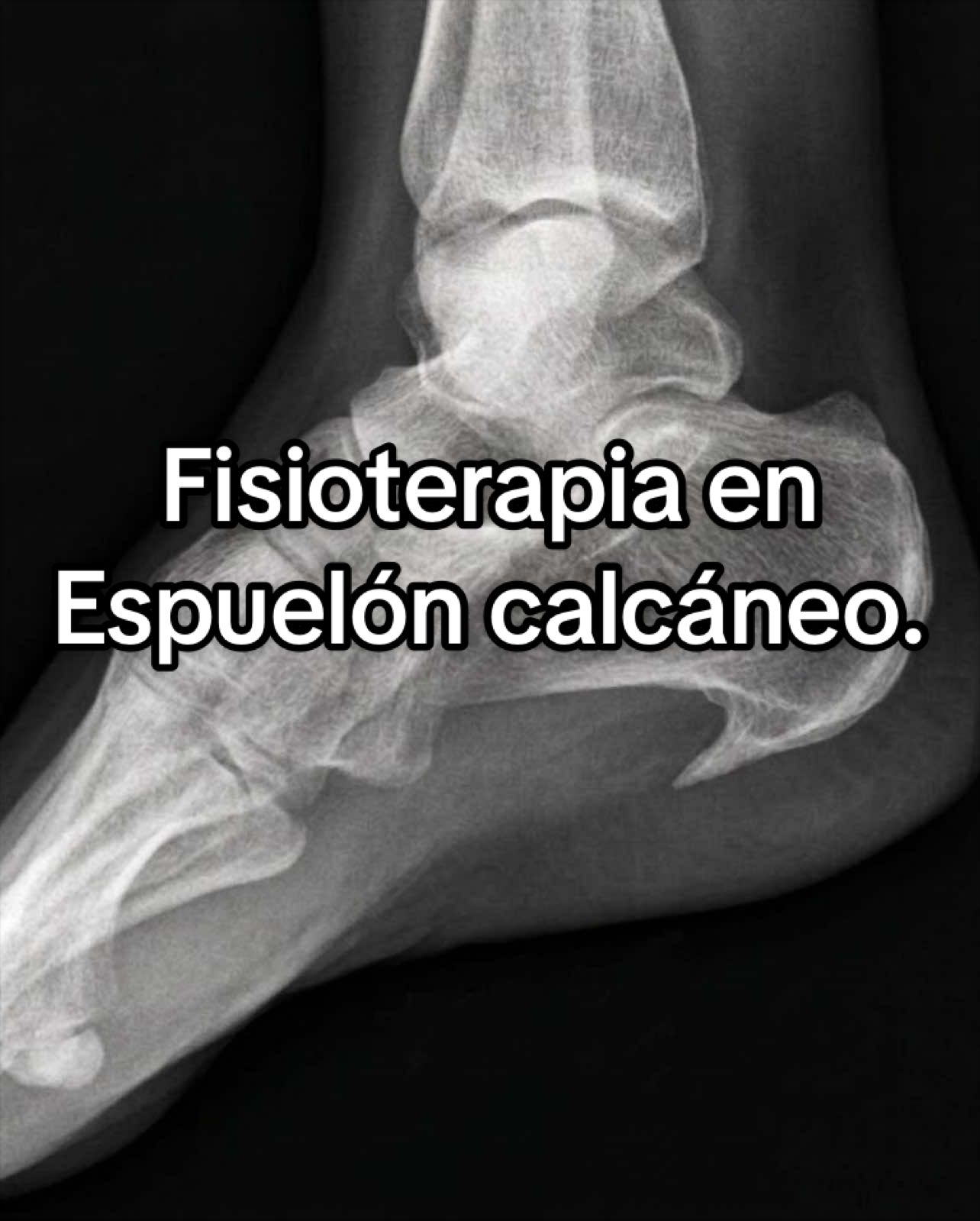 @FISIUS 👨🏻&zwj;⚕️