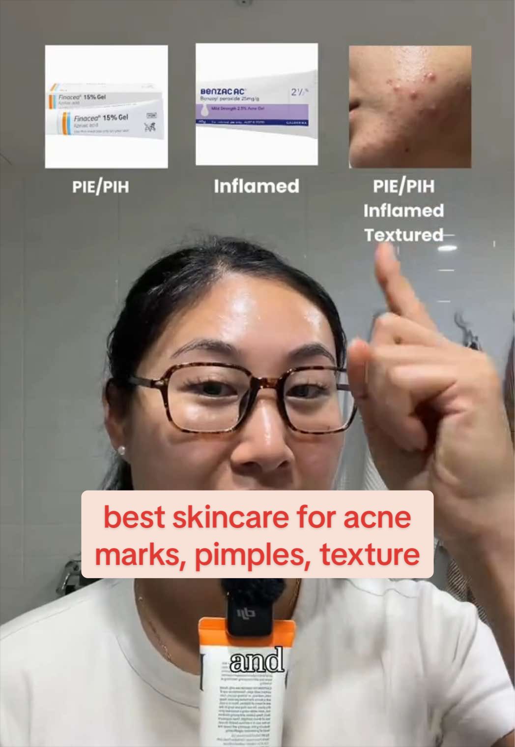 @Lisa | acne → clear skin