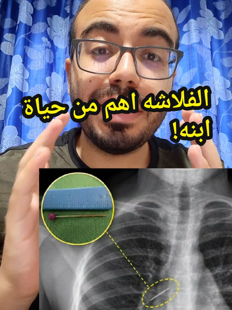 @Dr.ahmedsherif