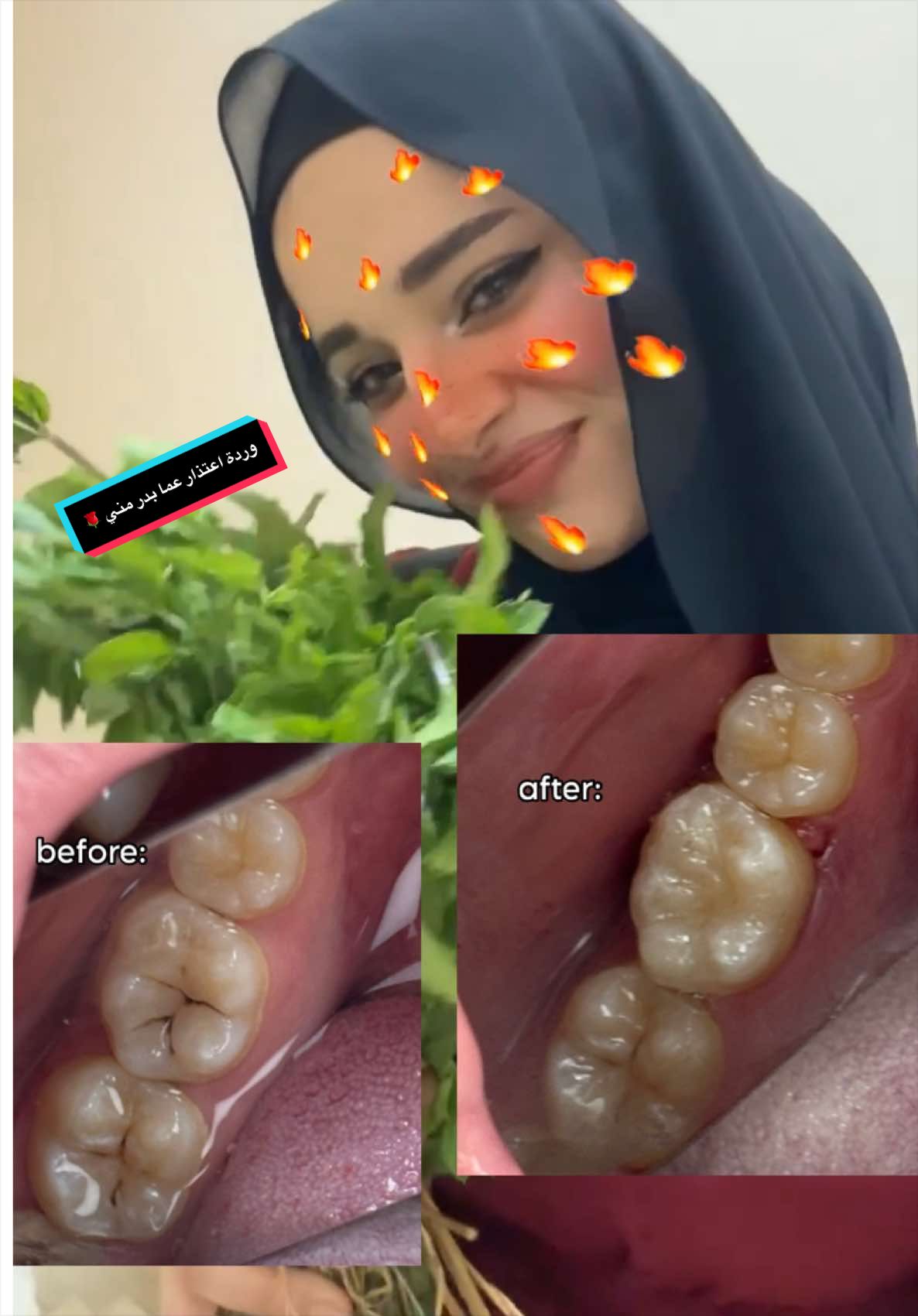 @teethtesst00