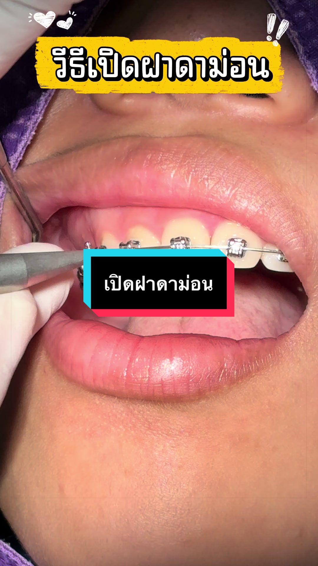 @ซอฟแอนด์สไมล์ลาดกระบัง