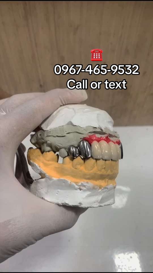 @Jobert affordable denture 🦷
