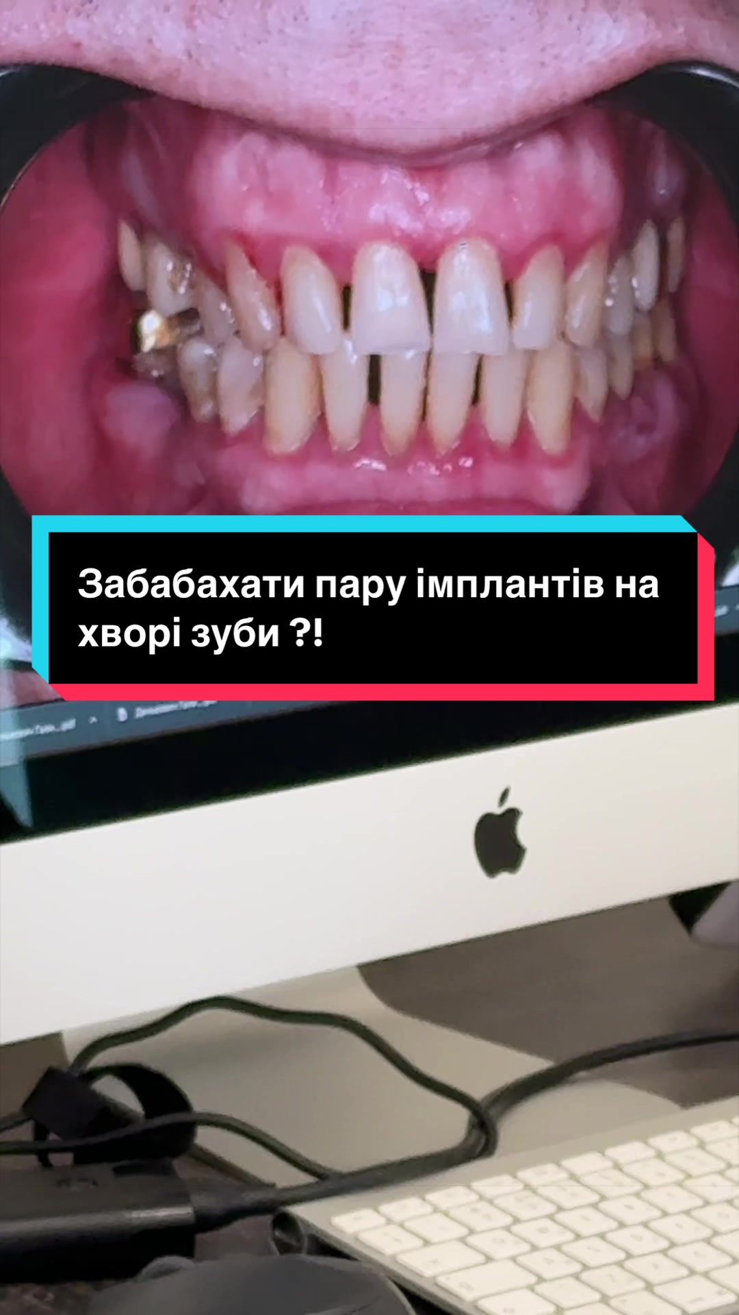 @Стоматологія ДрогобичMaxDental
