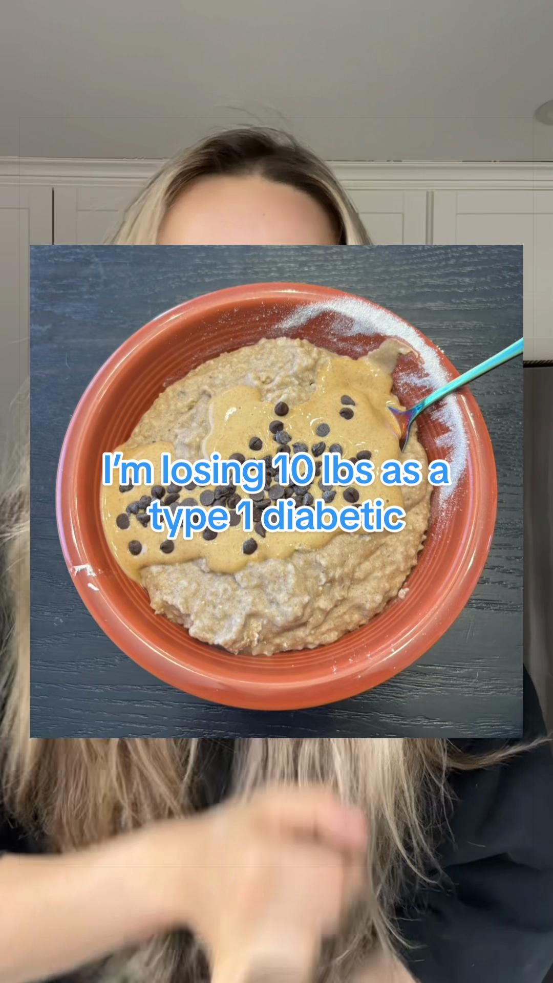 @TYPE 1 DEEABETES