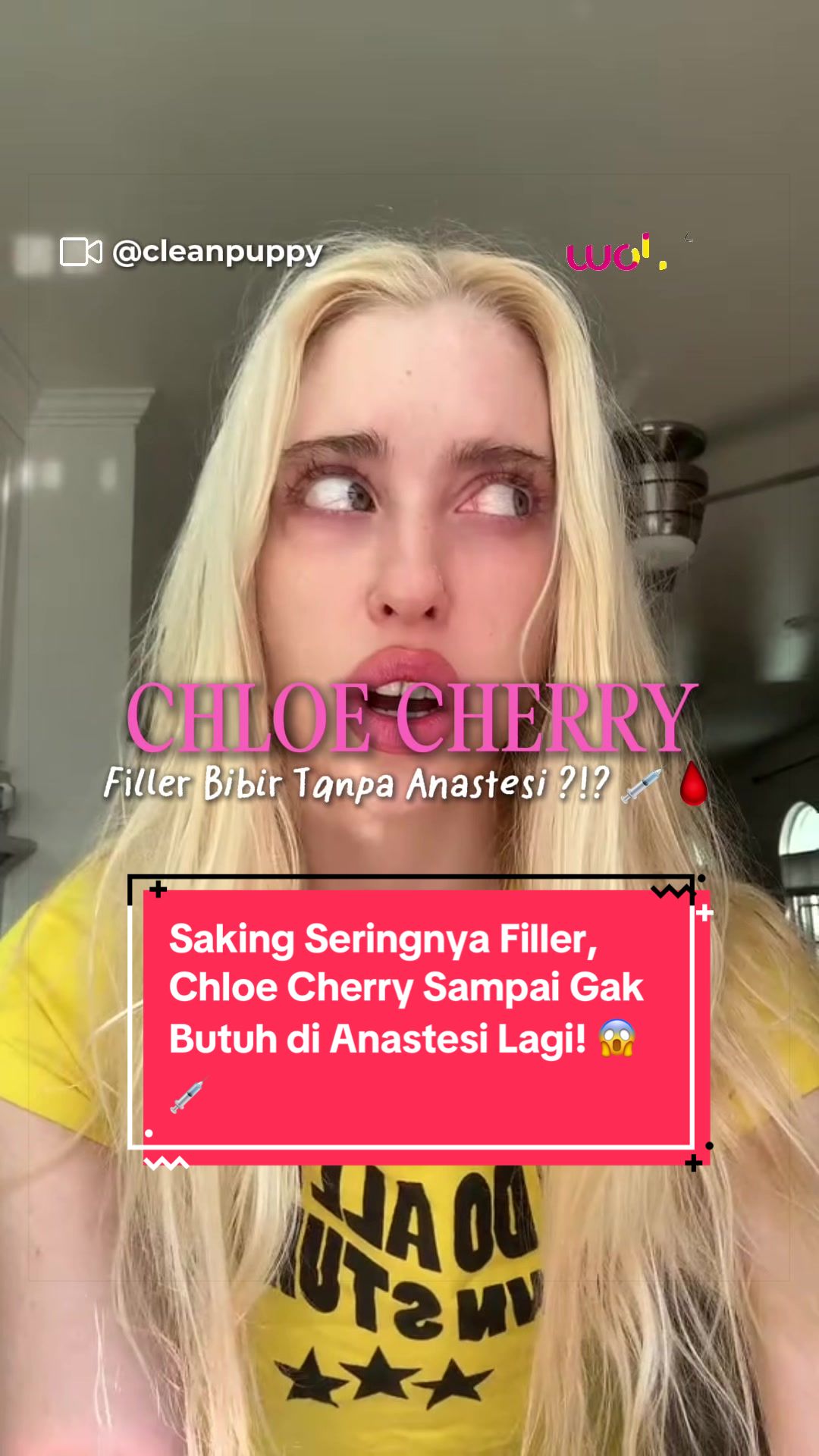 @wolipop