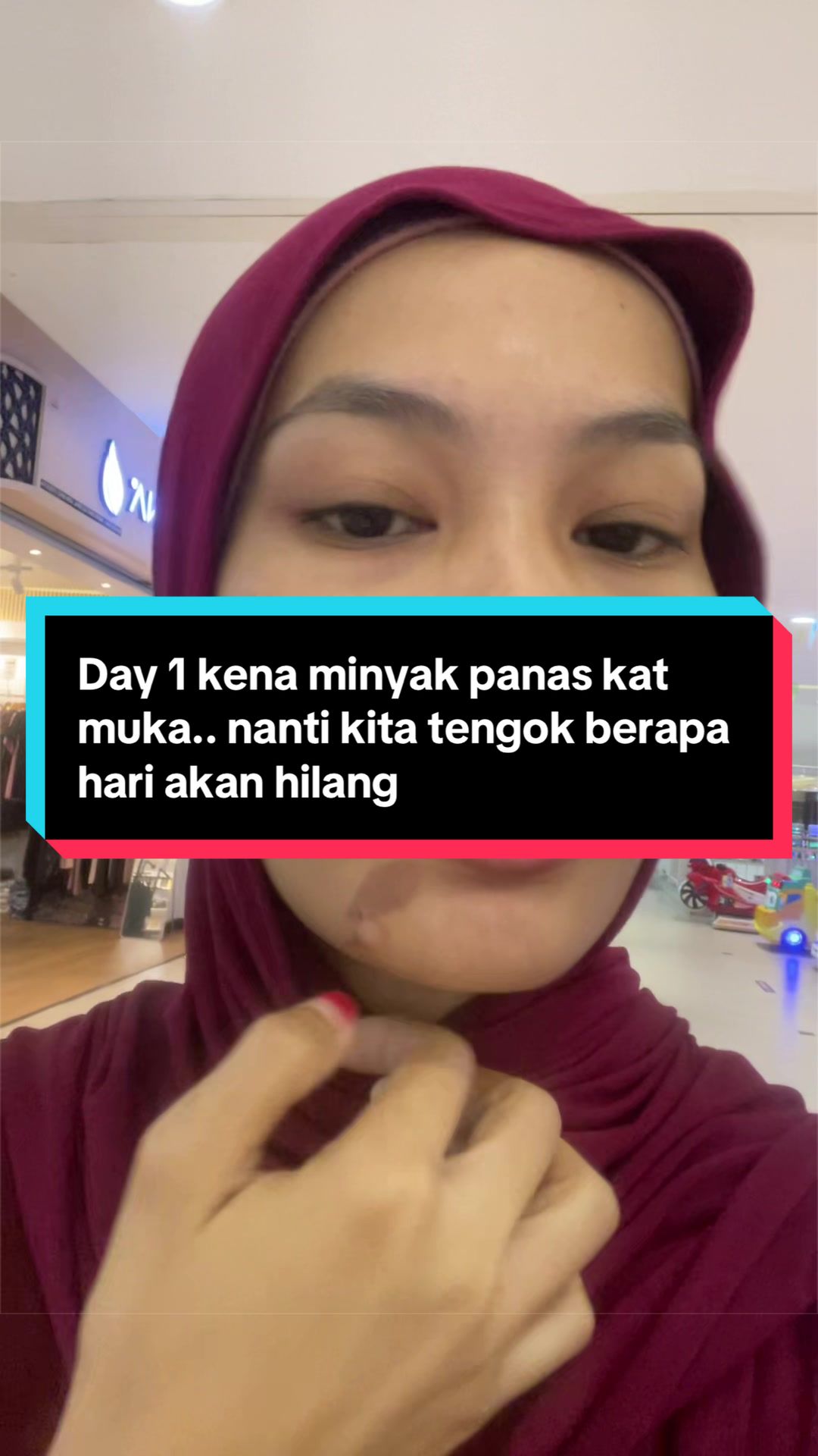 @YANA🌹