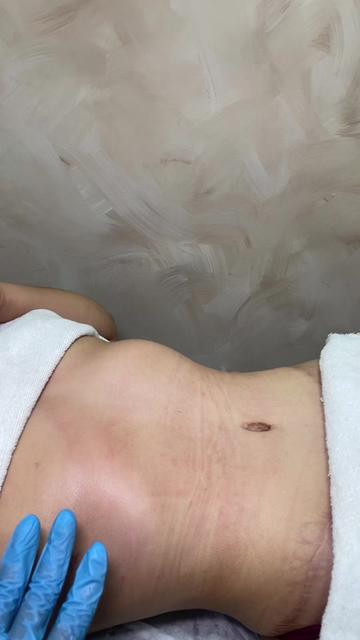 @Sarimar Tr&iacute;as