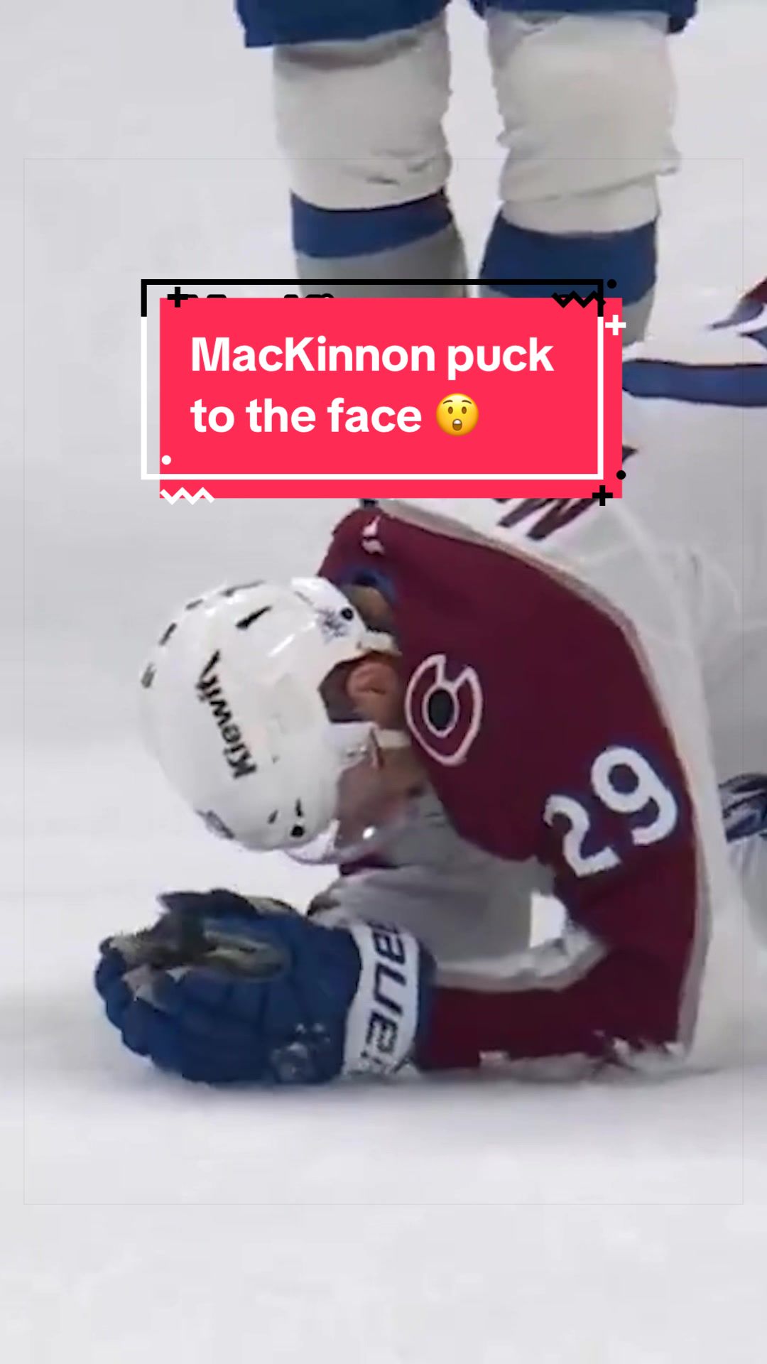 @BarDown