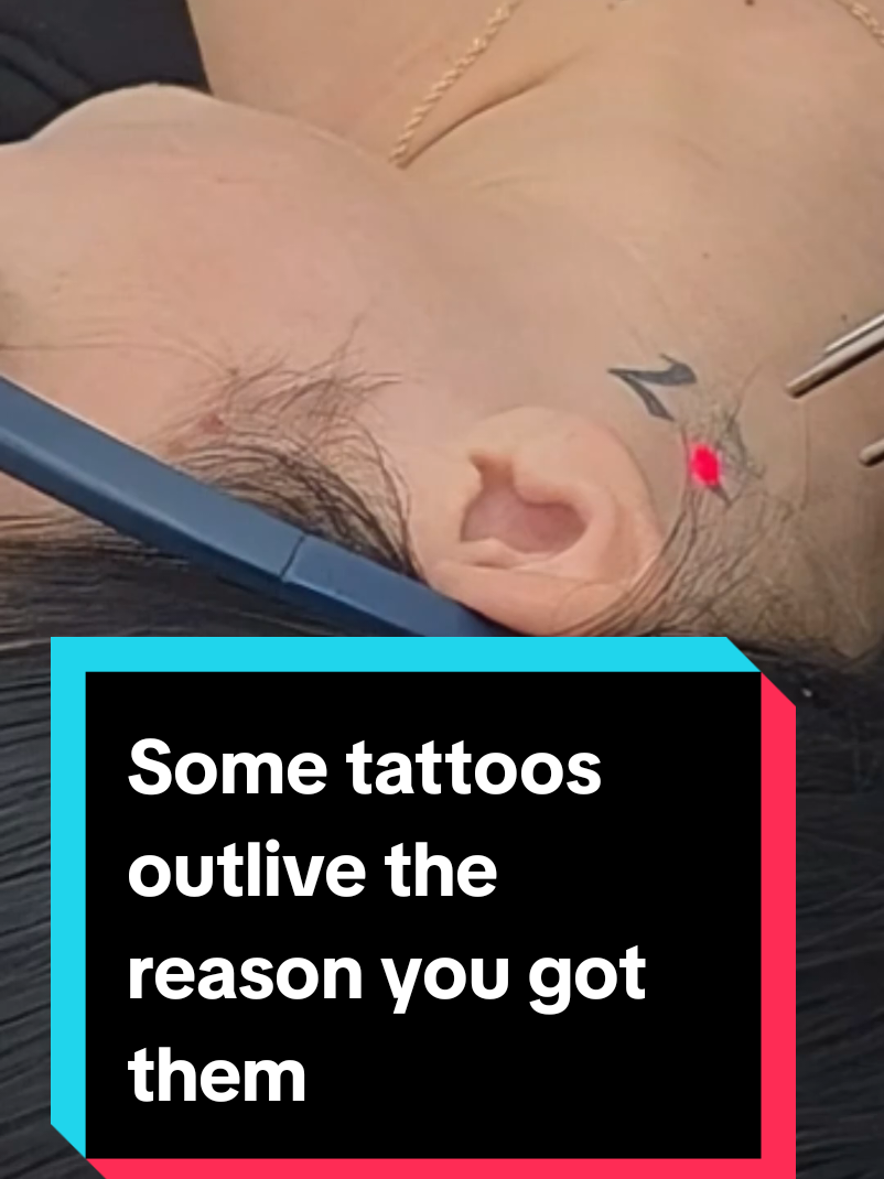 @Jamie T| Tattoo Removal Expert