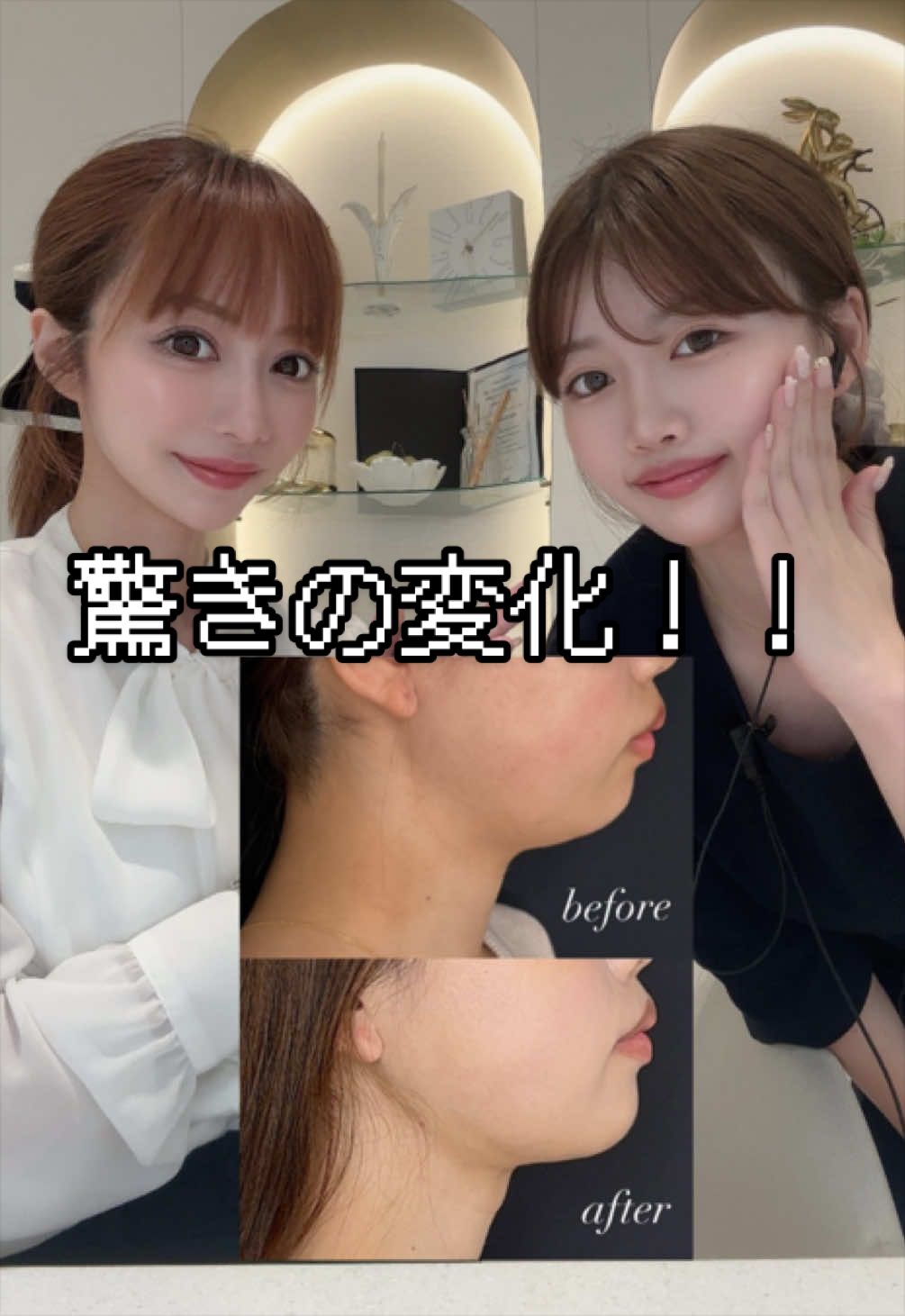 @りおなMGとのいMGの付き人