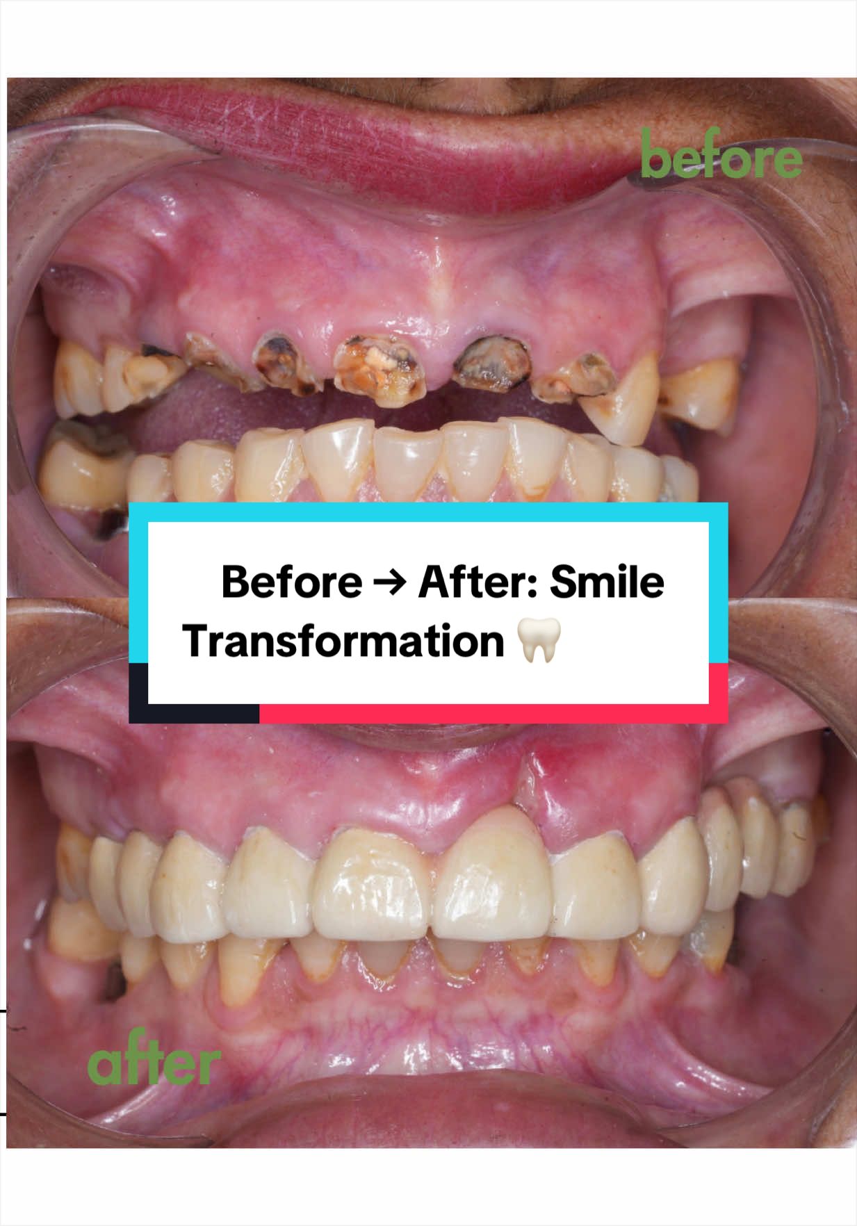 @Smile Engineer Dr Bidhan
