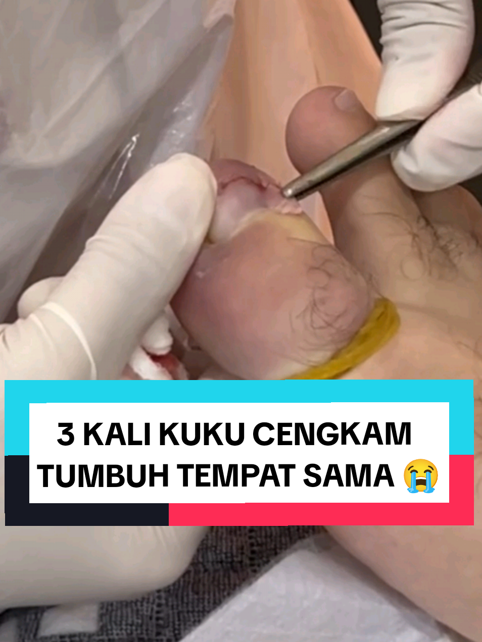 @Rawatan Kulit,Echo,Antenatal