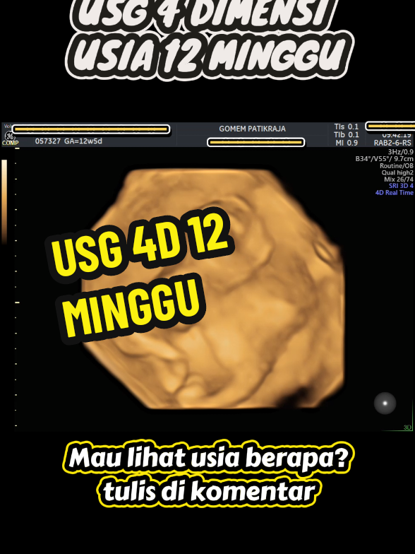 @USG 4D PURWOKERTO