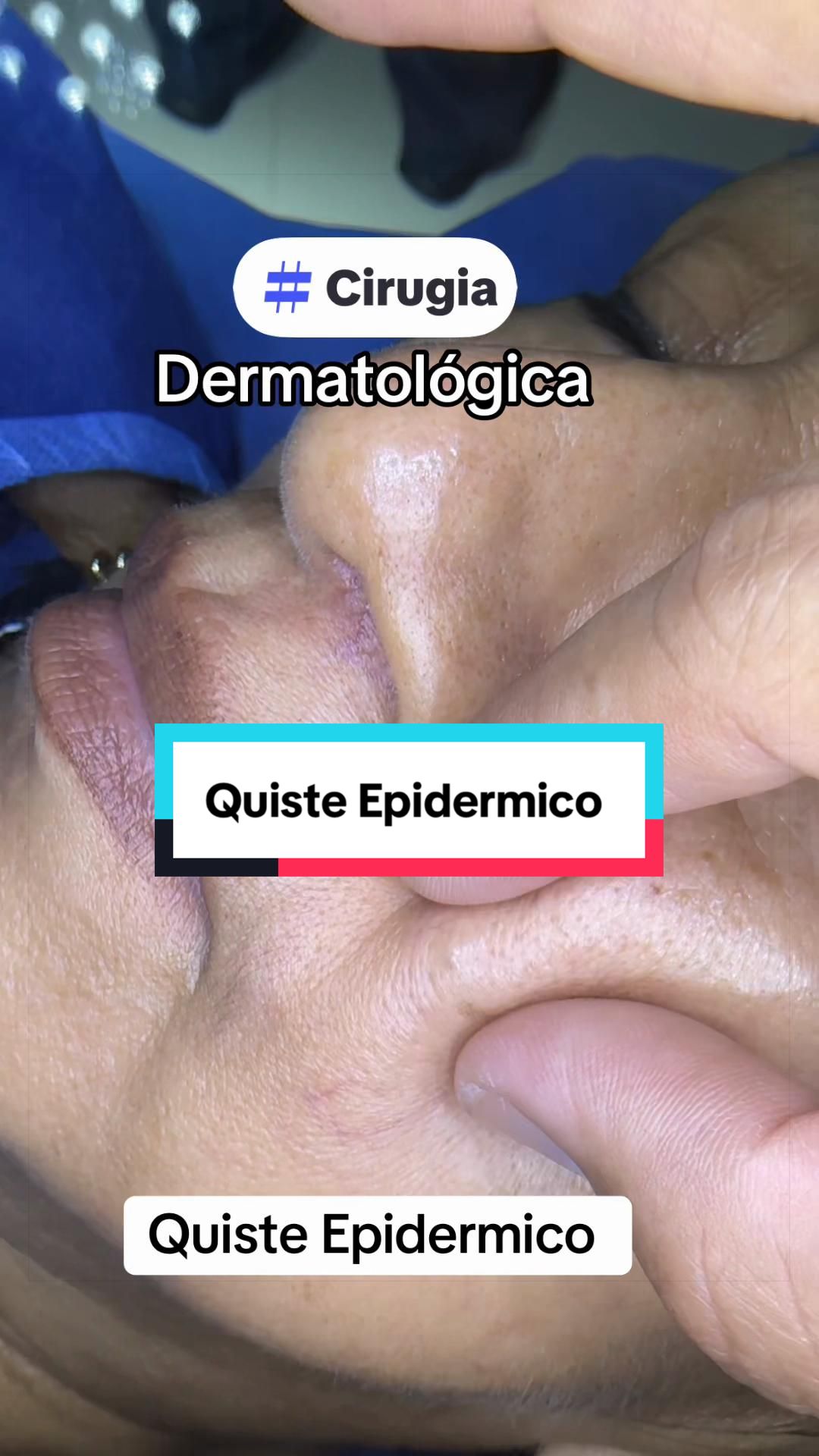 @Dr. Wilfrido Solano Derma
