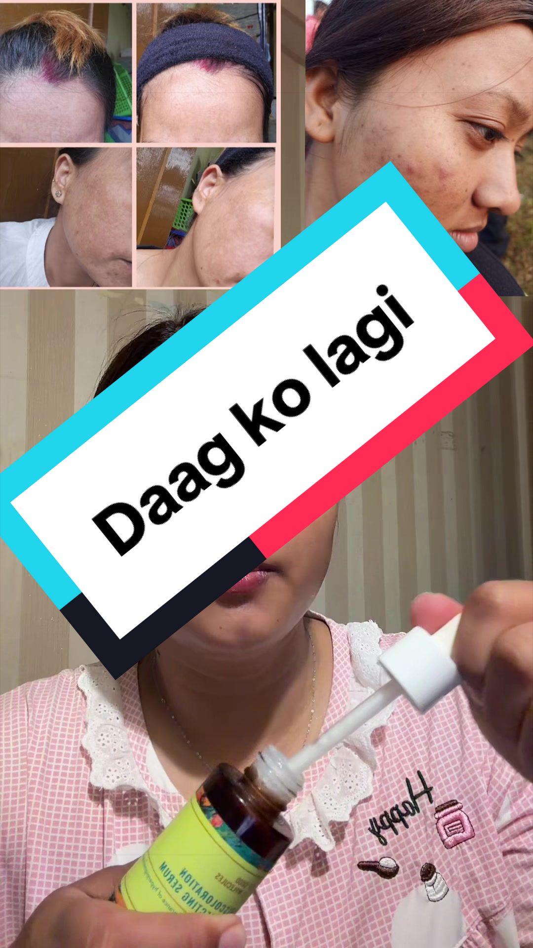 @Diksha Chamling