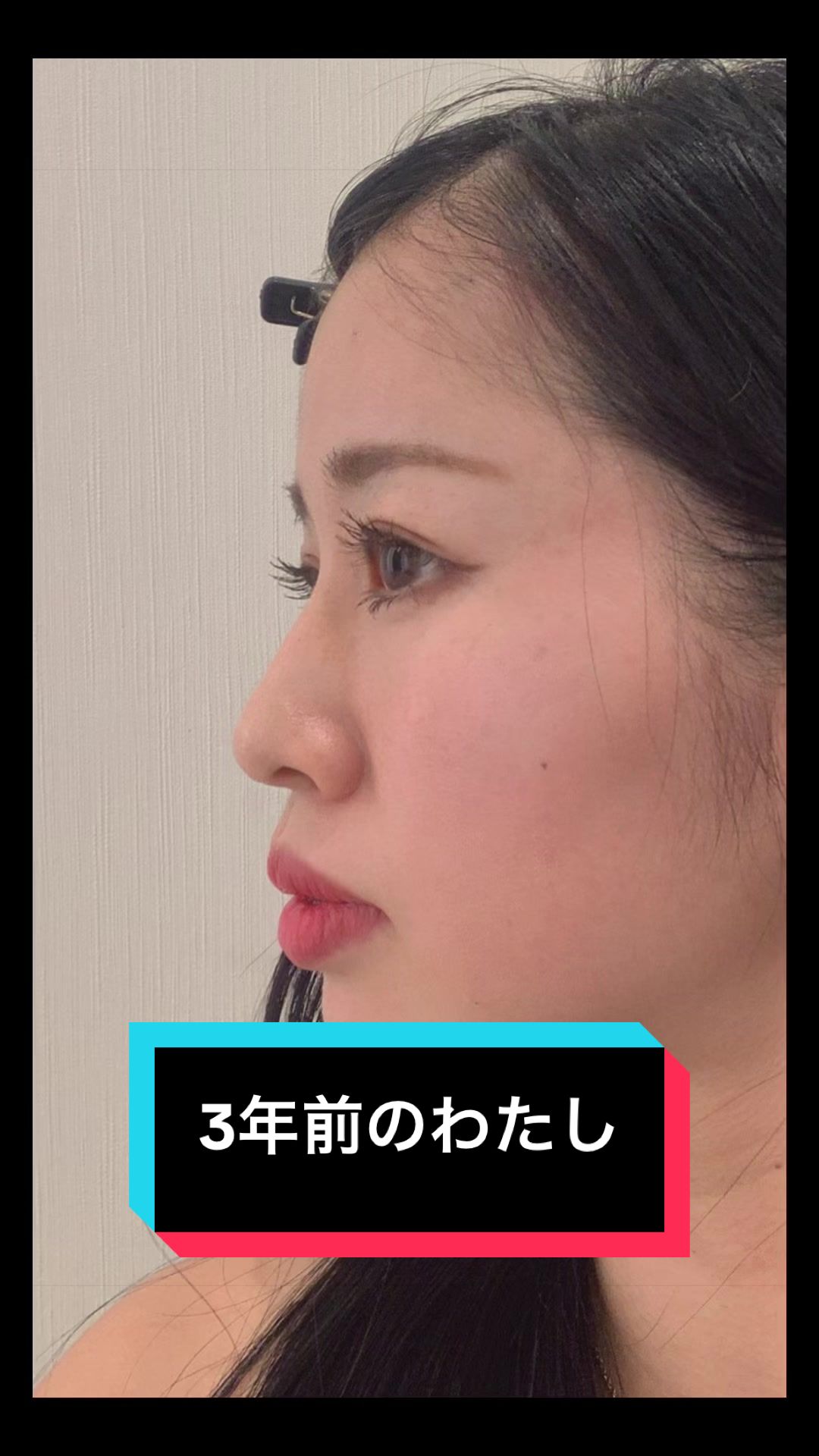 @Emichi