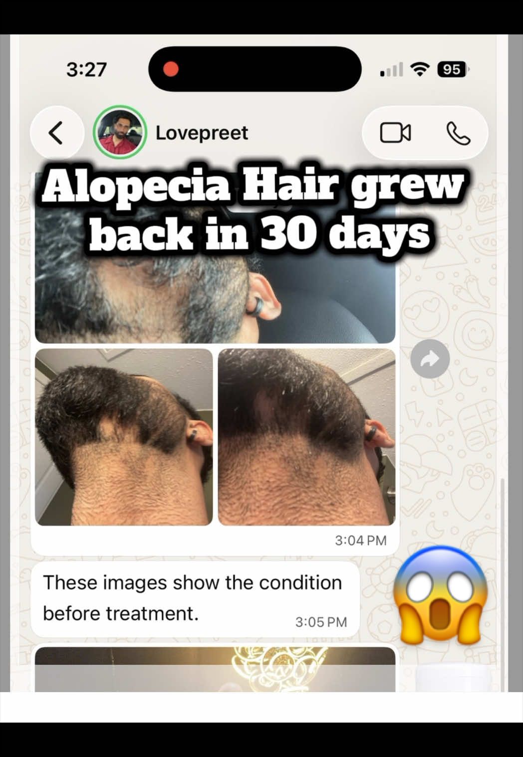 @money_beard_growthoil