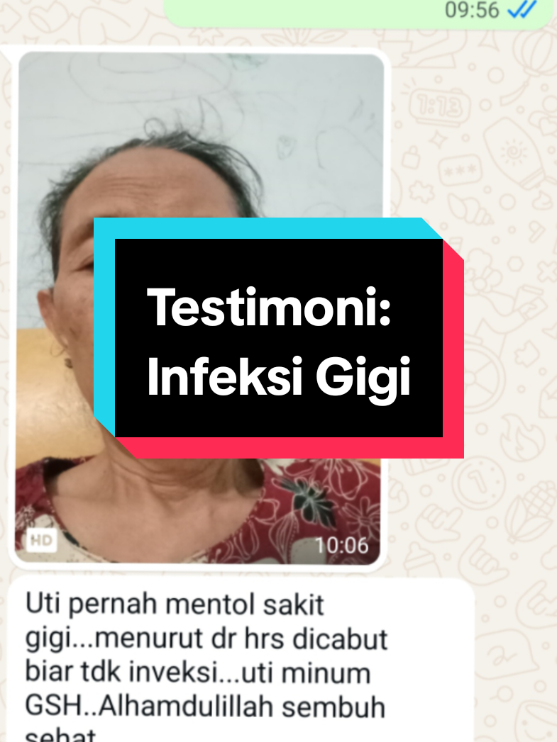 @Agen Resmi Glutera