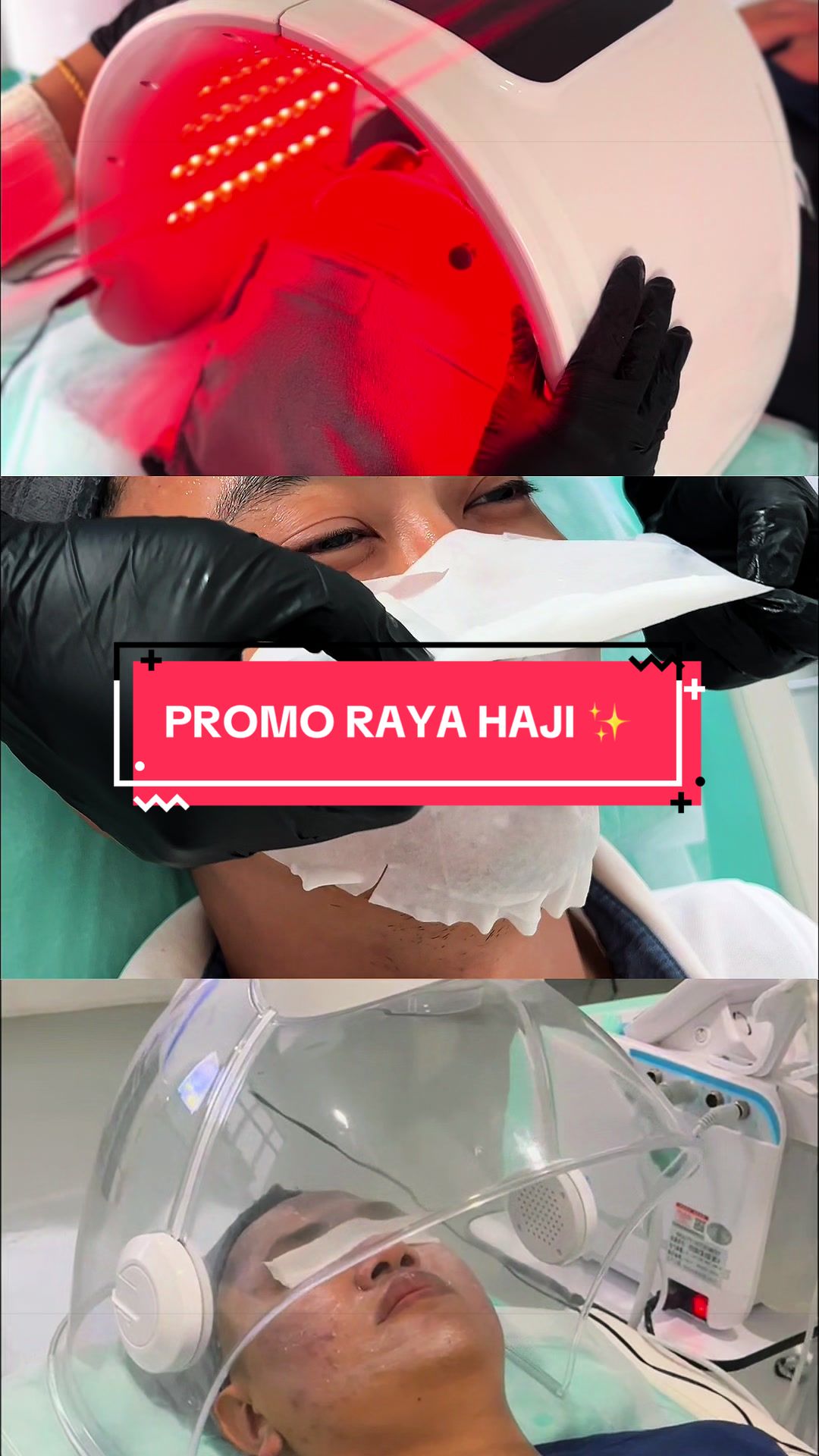@Jom facial cat