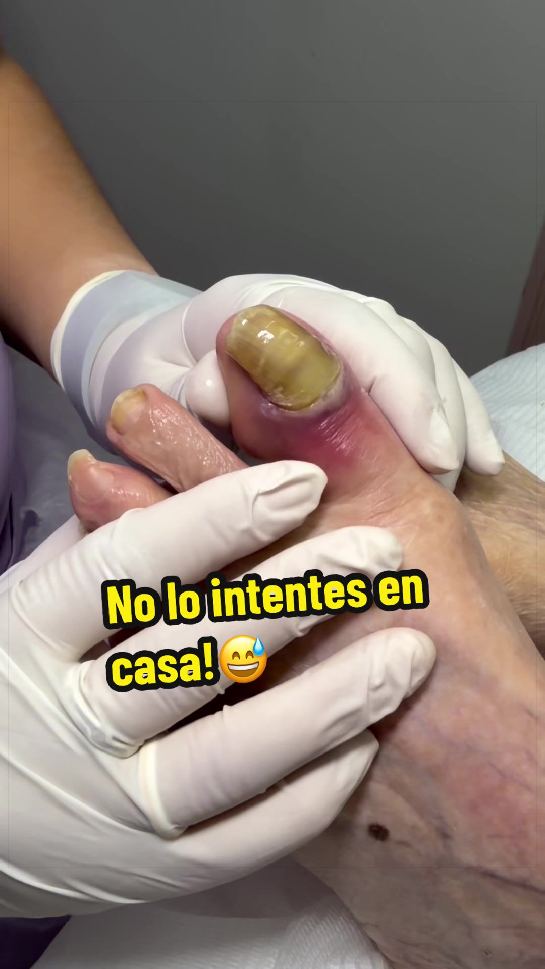 @podología calzada
