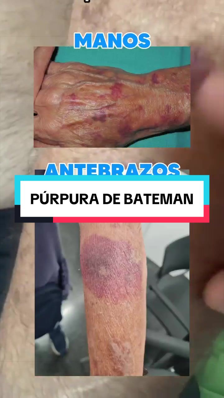 @Dr. Wilfrido Solano Derma