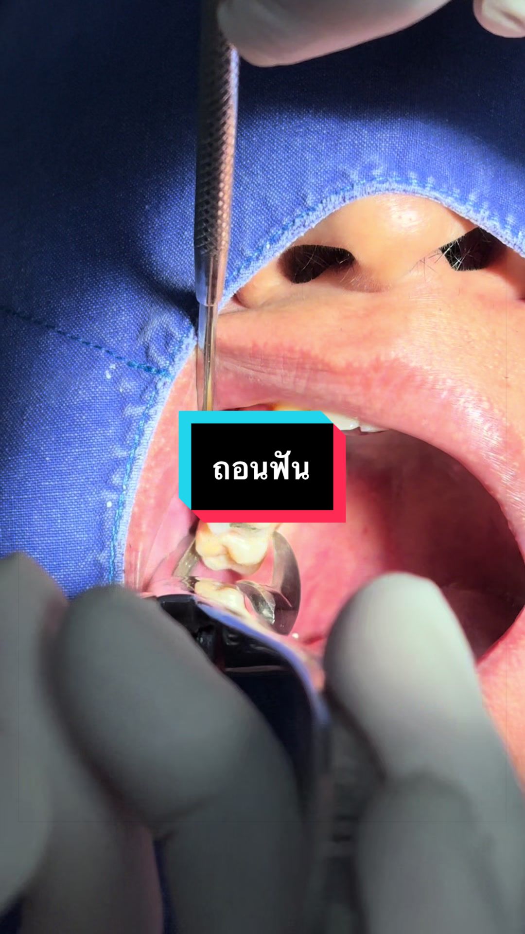 @ซอฟแอนด์สไมล์ลาดกระบัง