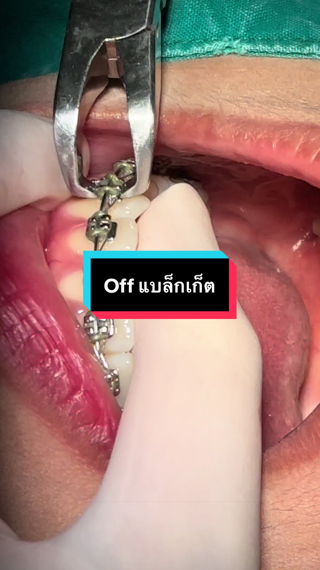 @ซอฟแอนด์สไมล์ลาดกระบัง