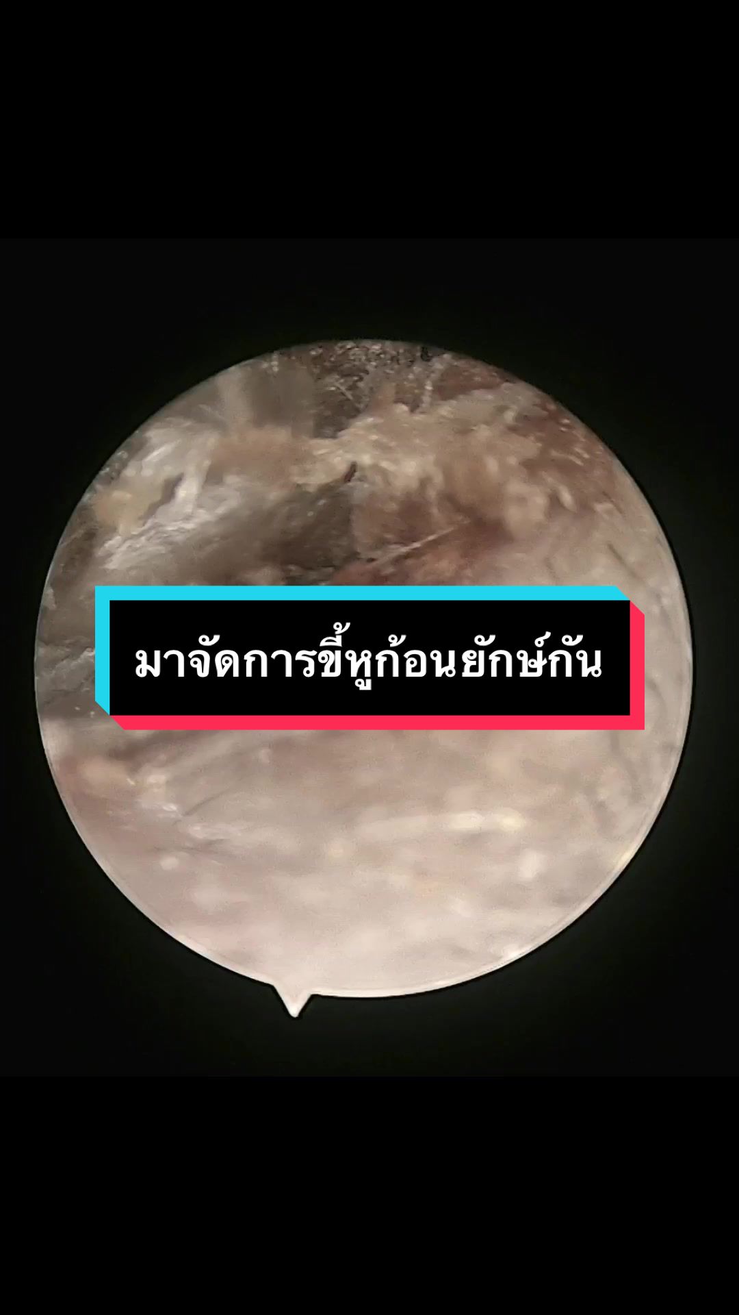 @คลินิกหมอณัฐธยาน์ หู คอ จมูก