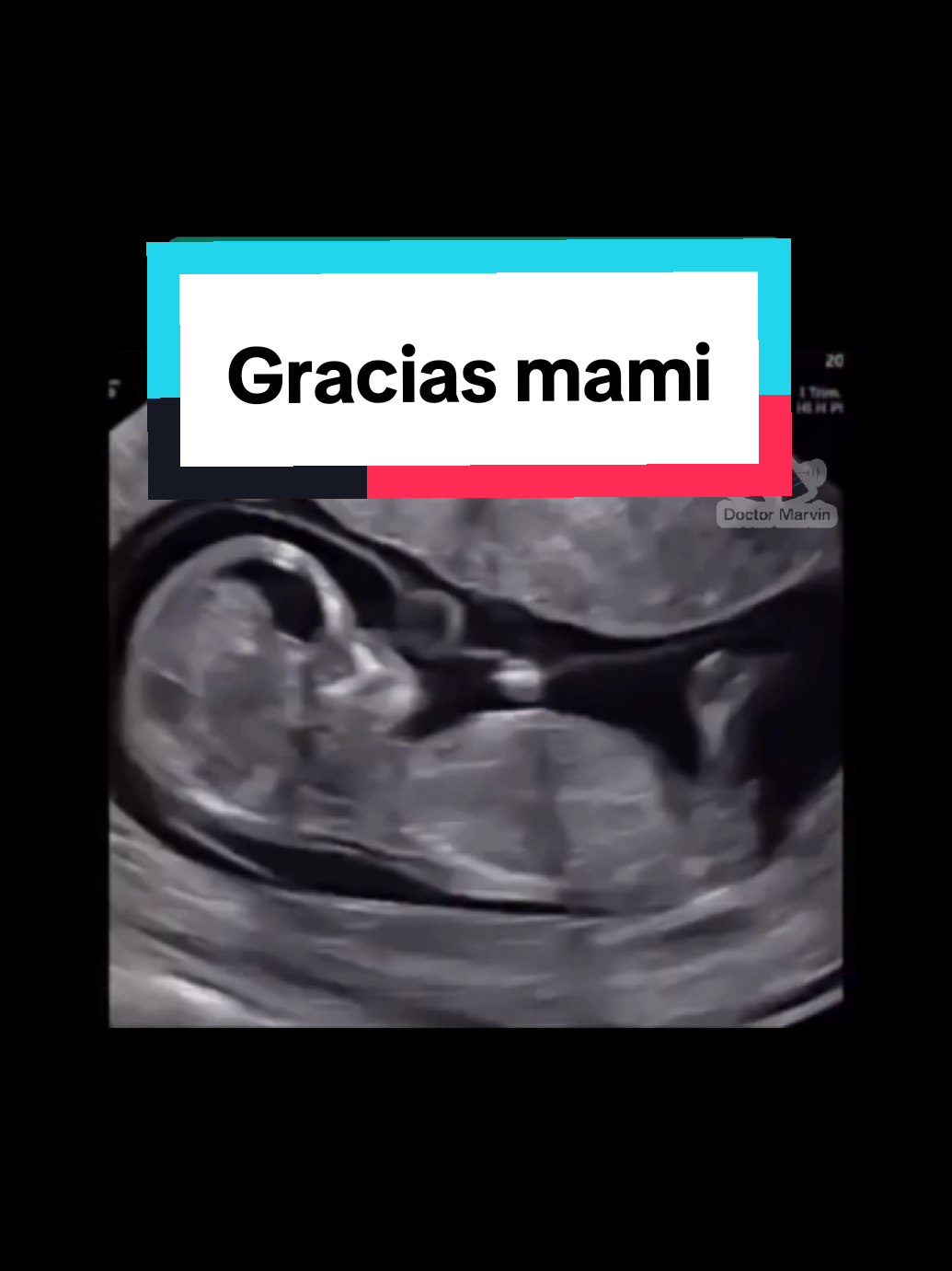 @Doctor Marvin 🔷