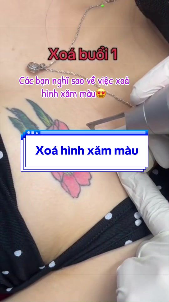 @Xo&aacute; xăm k sẹo H&agrave; Nội💧
