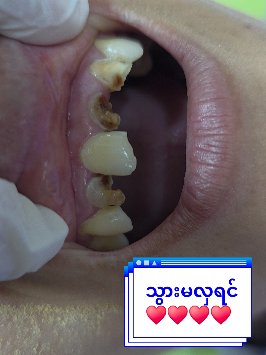 @Dr.KoKoSawMin(သွားဆရာဝန်)