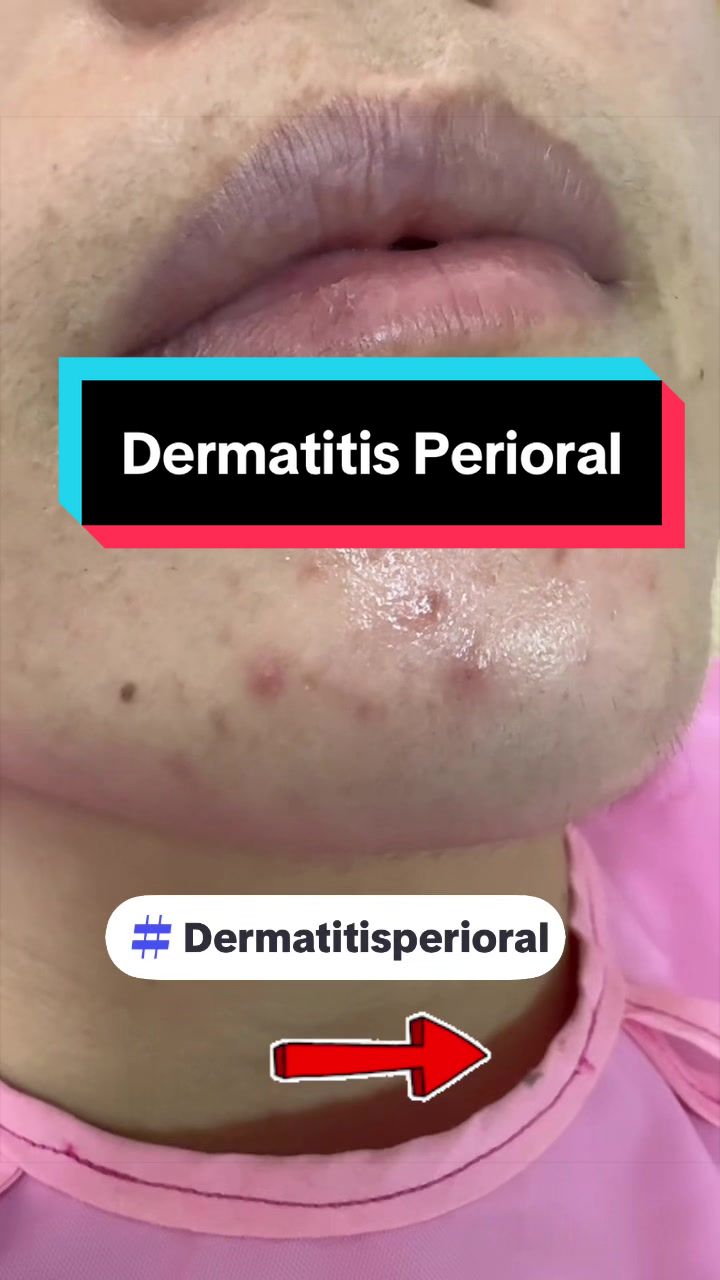 @Dr. Wilfrido Solano Derma