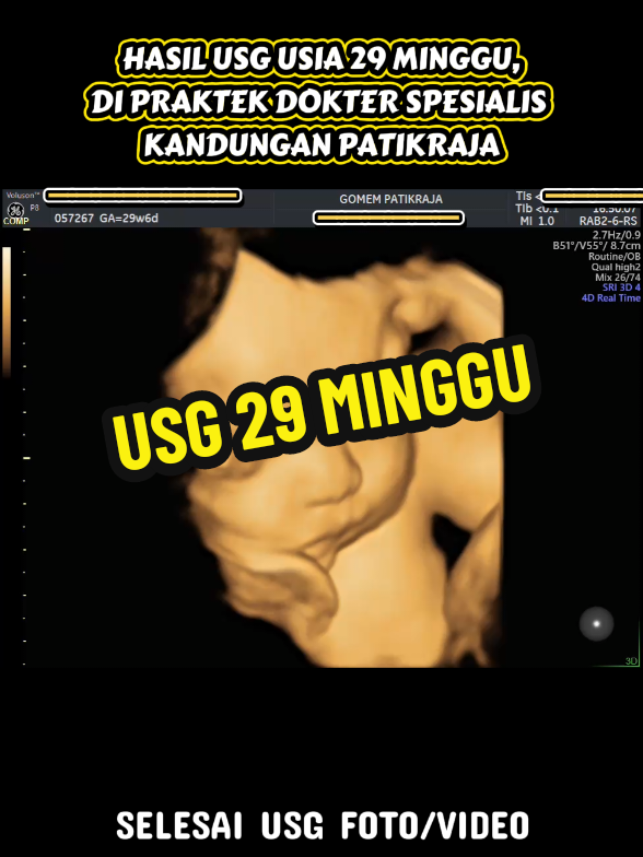@USG 4D PURWOKERTO