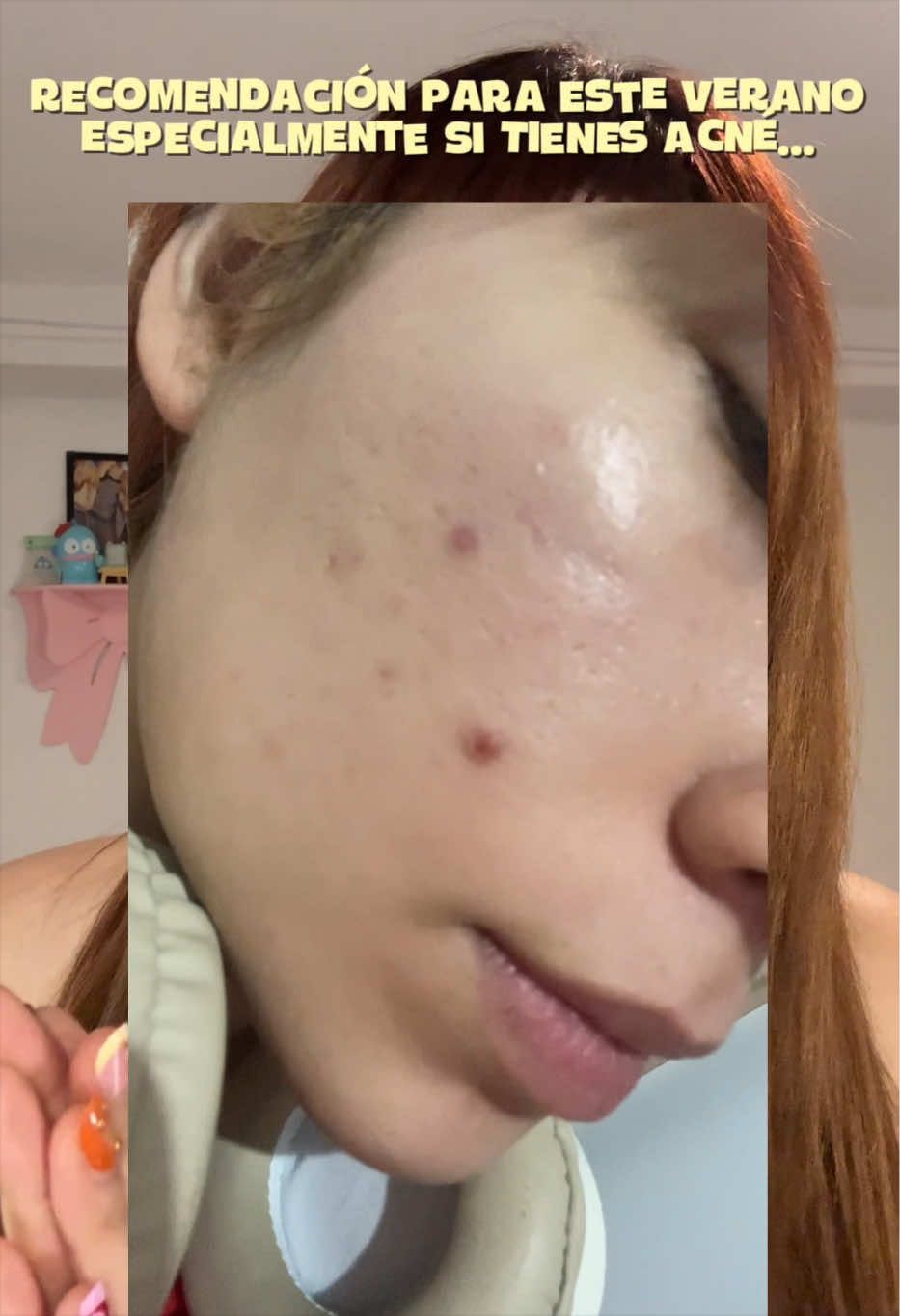 @๐๐๐๐๐๐๐ ๐๐๐