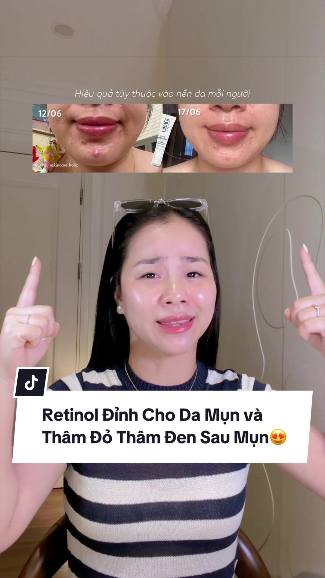 @Quin Skincareholic